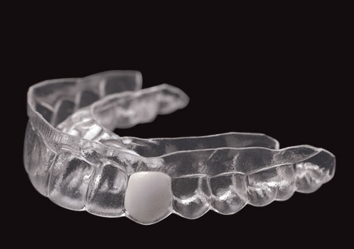 Dentsply Sirona Essix A+ Sert Plak Yuvarlak Çap 125 mm 040